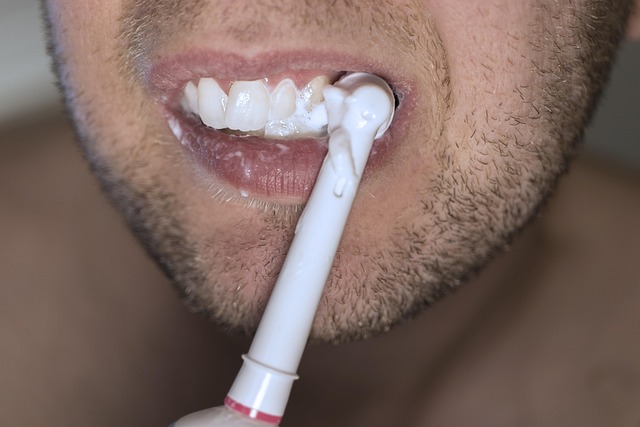 How to Get White Teeth: Proven Tips for a Brighter Smile